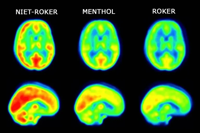 The hidden link between smoking, brain inflammation, and depression risk.